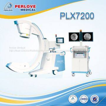 C-arm machines PLX7200 for bone fixing surgery