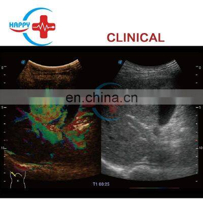 Sonoscape S60 Ultrasound Scanner Color Trolley Medical Ultrasound Machine