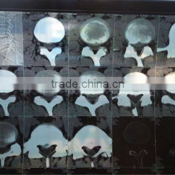 China resonance magnetique film KND-A/F CE