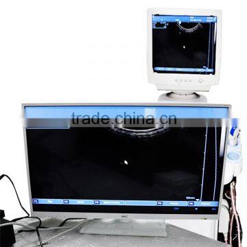 White+Bule Wholesale Medical Supplier Digital Ultrasound Machine for Pregnancy photo-5