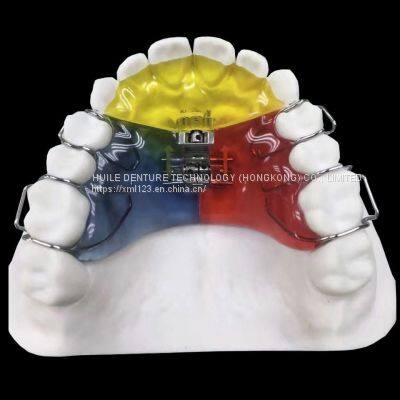 Orthodontic-Appliance China Dental Laboratory - Outsourcing Dental Lab photo-4