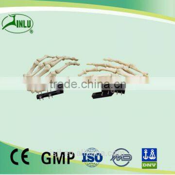 Finger Metacarpal Fractures External Fixation Frame