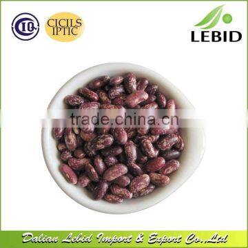 New Crop Heilongjiang Origin Purple Speckled Kidney Beans