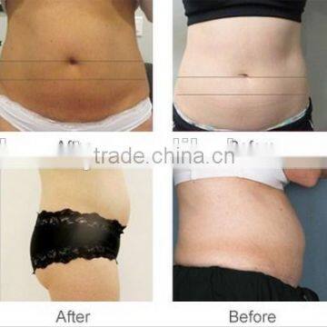 Non-invasive Fat Reduction Liposonic HIFU Machine for Body Slimming photo-5