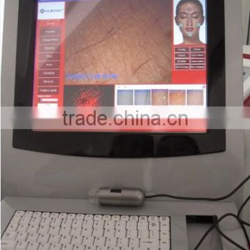 2015 special promotion! reveal skin analysis machine/skin analysis machine/ skin analyzer with CE