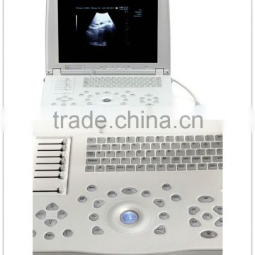 New Laptop Ultrasound Scanner for abdominal, cardiology, gynecology, obstetrics and urology