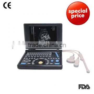 2015 new laptop ultrasound scanner (PC system) on Sale