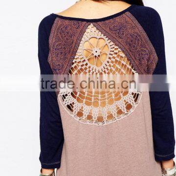 China Factory OEM ODM 2015 New Fashion Customized Round Neckline Tunic With Crochet Lace Back photo-4
