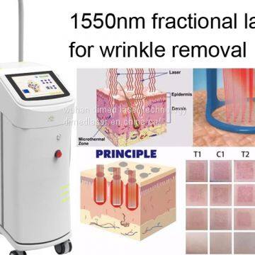 Non Ablative Wrinkle Laser Machine With 1550nm Erbium Glass Fractional Laser Technology