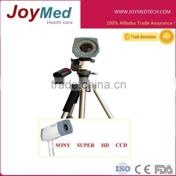 medical electric colposcope / electric digital video coloscope/ Unique HD colposcope with 3.27M pixels