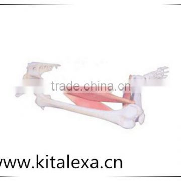 Muscle fixed point, fixed point, dynamic model KA-TP00026