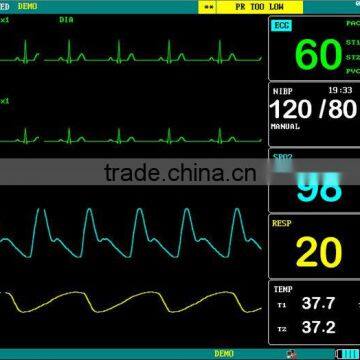 Jumper JPD 800B Vital Signs Veterinary Patient Monitor -clinic Animal Monitor photo-2