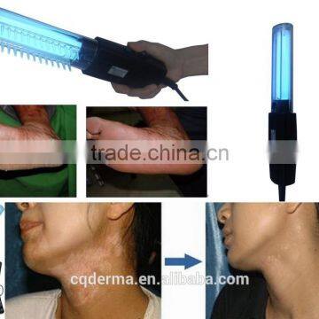 311nm Vitiligo Psoriasis Treatment Handheld House Use uv Lamp photo-4