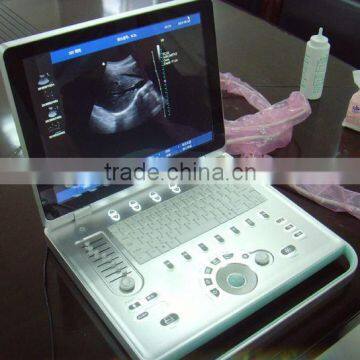 3d Color Doppler Ultrasound Scanner Portable With Optional Transducers photo-4