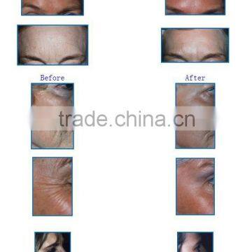YUWEI RF Radio Frequency Eye Body Face Lift Eye Care Massage photo-6