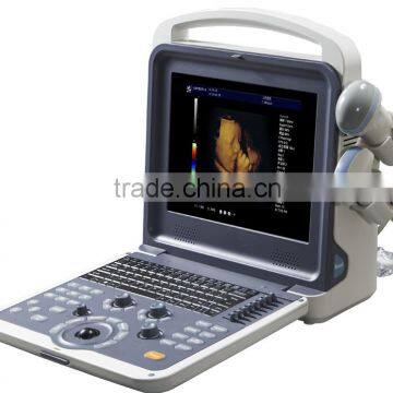 MC-DU-06 Portable Color Doppler Ultrasound Scanner