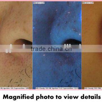 Magic Mirror Facial Skin Analyzer Machine for Skin Test photo-3