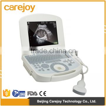 Electric Ultrasonic equipment high-frequency beam-former cheap ultrasound machine price