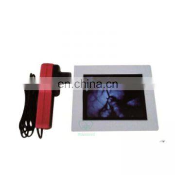 MY-G061E New Arrival Good Price Handheld Medical Infrared portable Vein Finder