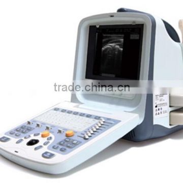 MCB-9300 Black and White Ultrasound Machine