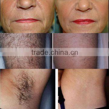 2015 BeiJing KES 3 Handpiece E- Light Hair Removal Machine Med-140c+