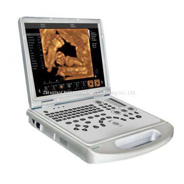 Portable 4D Color Doppler Ultrasound Scanner photo-3