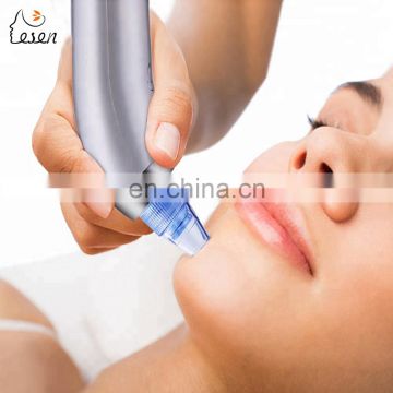 Fashionable Suction Device to Remove Blackheads