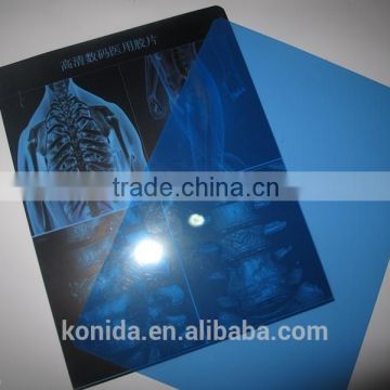 2015 new products medical dry film, x ray film for fuji printer the most popular China supper supplier