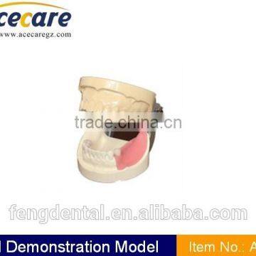 dental supply Implant practice model AC-P7