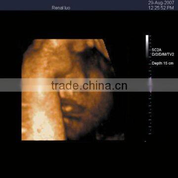 3d Color Doppler Ultrasound Scanner Portable With Optional Transducers photo-6