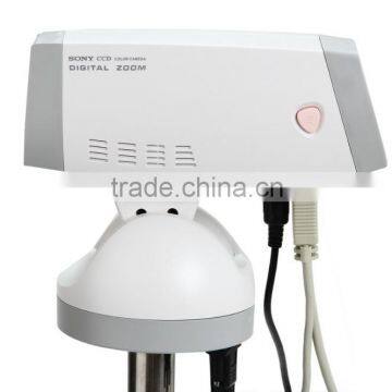 PC Software Digital Electronic Colposcope For Clinical Detection photo-5