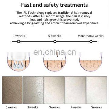 Cheap Epilator Ipl Permanent Hair Removal Laser Diode Machine 500000 Flashes photo-5