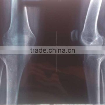 fuji x-ray film, x-ray blue film of medical accessories wholesale