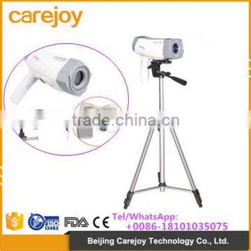 New Electronic digital video colposcope sony camera for Vagina