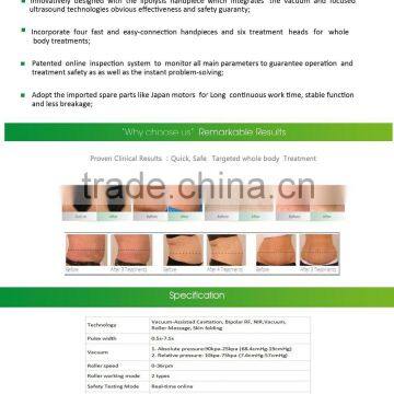 Best rf Skin Tightening Face Lifting Machine RF Beauty Machine