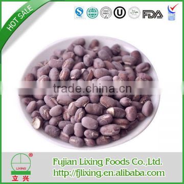 Popular best sell freeze dried mung bean sprout