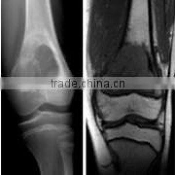 Good Sale Konida Medical Photosensitive Dry Laser X-ray Film photo-2