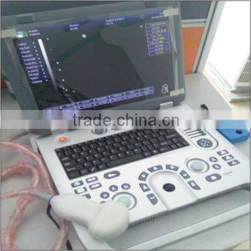 (MSLCU18)3D 4D Handheld Color Doppler Medical Ultrasound Scan Machine photo-3