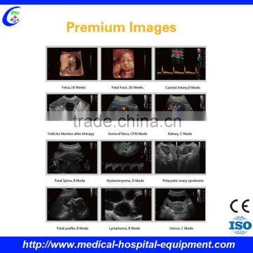 Portable Doppler Ultrasound Machine