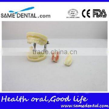 Dental Implant Practice Model DEA-31 Teeth Implant Models