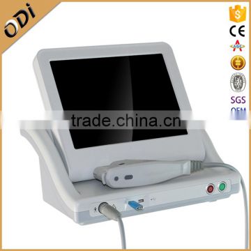 2016 best high intense ultrasound facial lifting hifu OD-H7