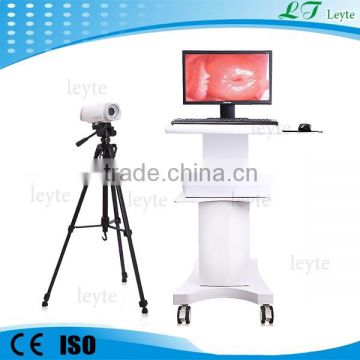 LT9802 used video colposcope supplier Electronic colposcope prices