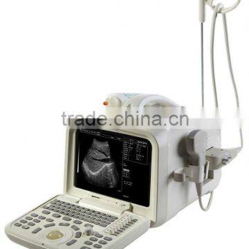 pc ultrasound scanner with CE mark