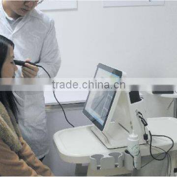 Sonostar Full Digital Portable Ophthalmic A/B Ultrasound Scanner Machine SAB-500 photo-5