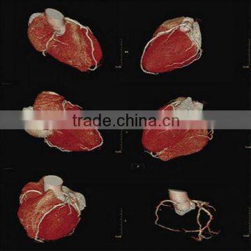 Medical Thermal Film