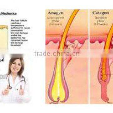 Best Choice Aroma Diode Laser With Fast Hair Removal Technology in Usa photo-4