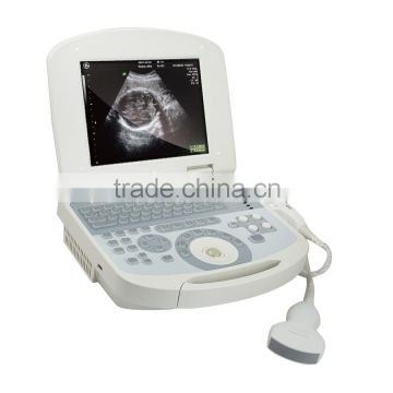 2016 hot sale full digital B mode human laptop portbale ultrasound scanner