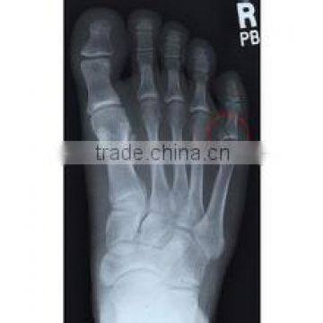 Good Quality Konida Automatic Medical X-ray Fuji Dry Film Agfa Holder Processor photo-3