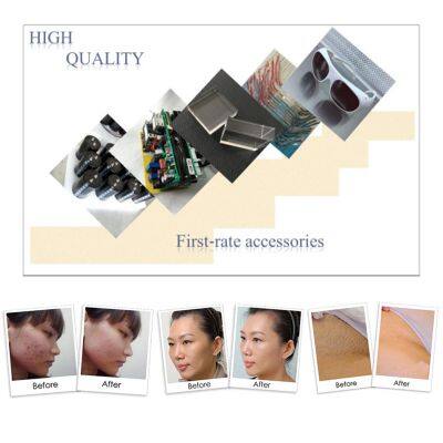 QM-120 IPL+SHR Hair Removal and Skin Rejuvenation Beauty Equipment photo-5