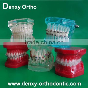 differnt types OEM dental orthodontic study model